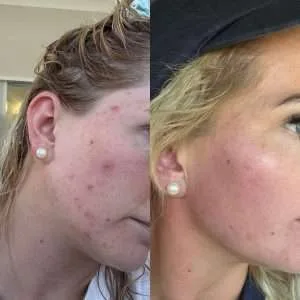 10-Day Detox Before & After