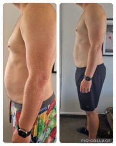 10-Day Detox Before & After