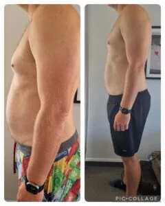 10-Day Detox Before & After