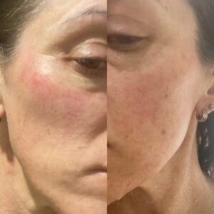 10-Day Detox Before & After