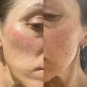 10-Day Detox Before & After