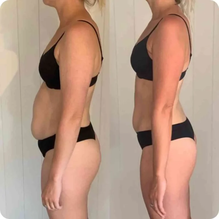 10-Day Detox Before & After