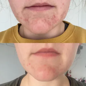 10-Day Detox Before & After