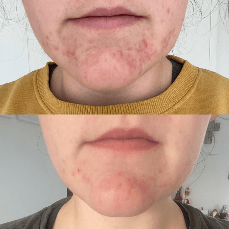 10-Day Detox Before & After
