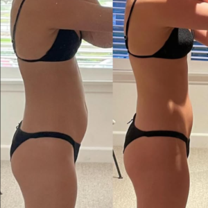 10-Day Detox Before & After