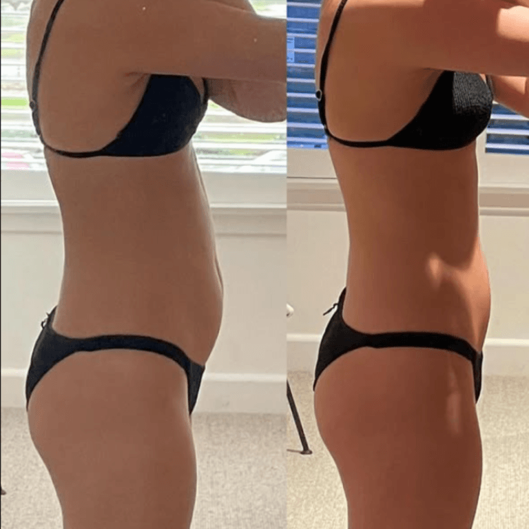 10-Day Detox Before & After