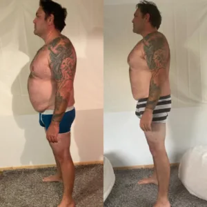 10-Day Detox Before & After